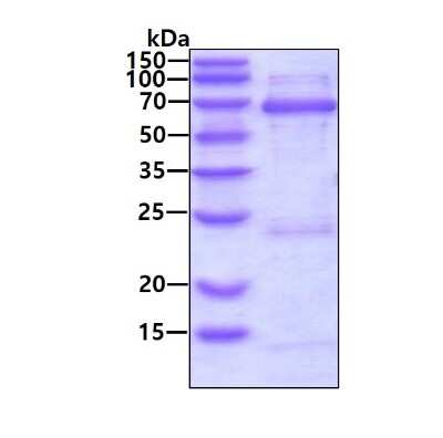 SDS-PAGE: Recombinant Human ZWILCH His Protein [NBP2-51721]